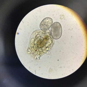 Female rotifer